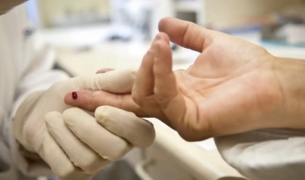 Carnaval de Recife (PE); 125 positivaram para sífilis e 10 para HIV