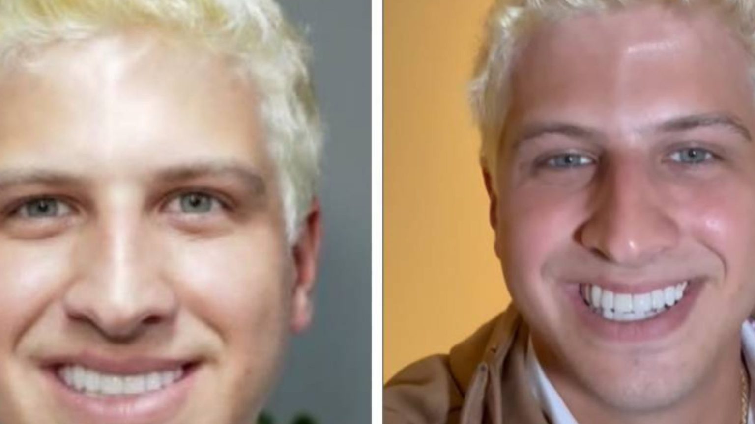 Redes sociais de João Campos custaram R$ 1,2 mi à Prefeitura do Recife em 2023