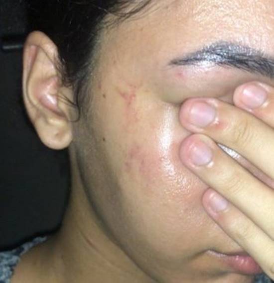 Estagiária da Facape denuncia agressão durante atendimento; faculdade garante suporte e ampliar segurança