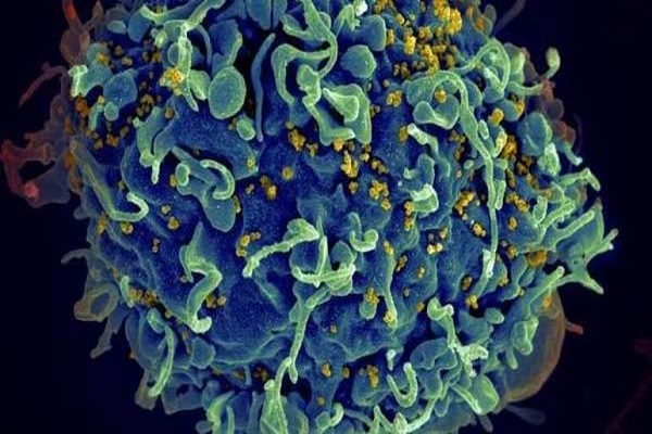 Cientistas anunciam o 7º caso de provável cura do HIV  — Blog Edenevaldo Alves