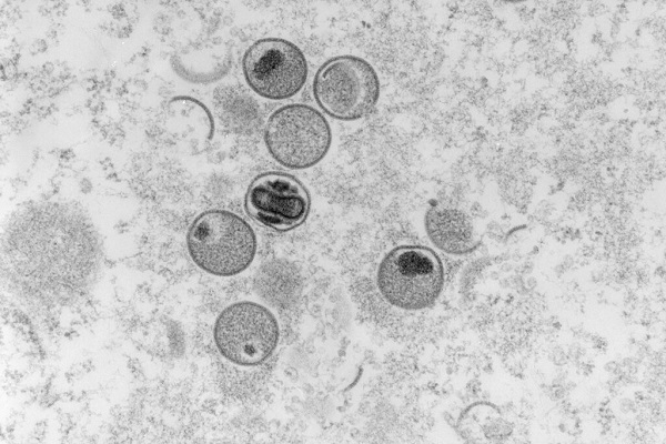 OMS convoca reunião do comitê de emergência devido à varíola dos macacos — Blog Edenevaldo Alves