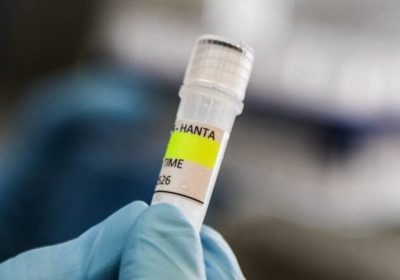 Em 2026, o Brasil registrou um óbito confirmado por hantavírus. Em 2026, o Brasil registrou um óbito confirmado por hantavírus.