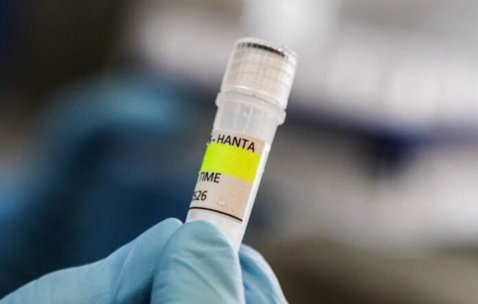 Em 2026, o Brasil registrou um óbito confirmado por hantavírus.