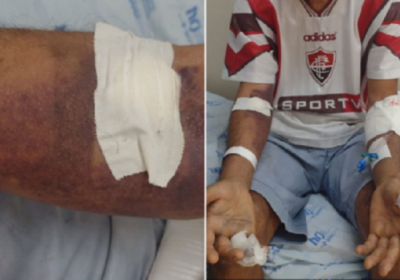 Casa Nova (BA): Homem é picado por jararaca e é socorrido para o hospital