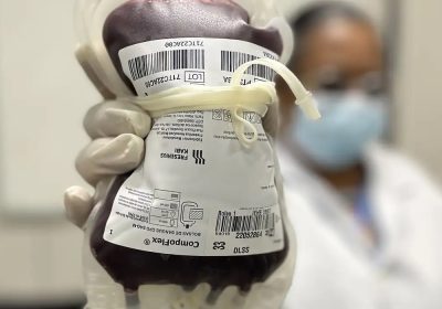 Saúde aprova novo protocolo de tratamento para hemofilia em crianças